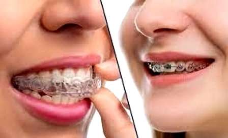 ارتودنسی دندان در بابل