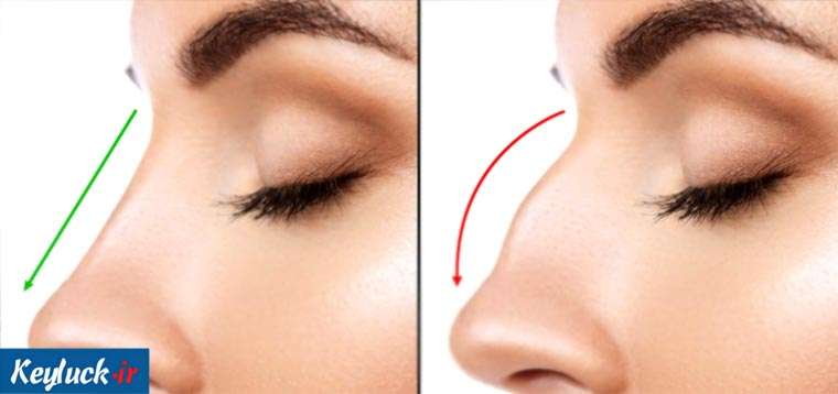 بهترین دکتر جراحی بینی در تهران