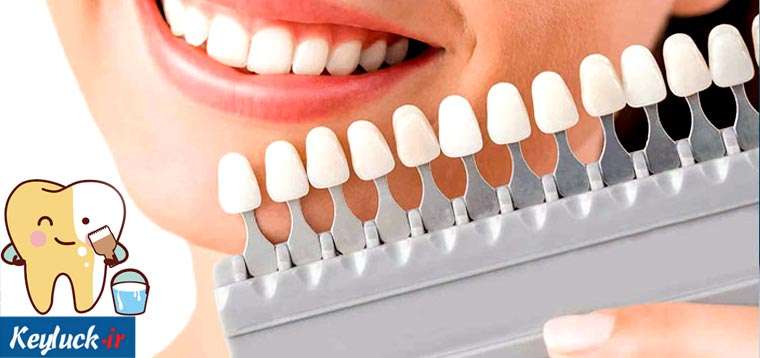 ۳ روش برای سفید کردن دندان چیست؟