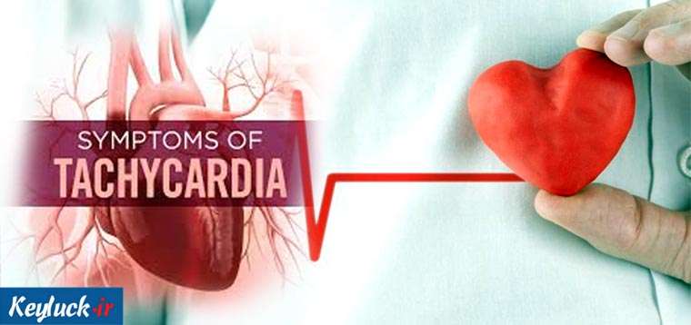 تاکی کاردی چیست؟