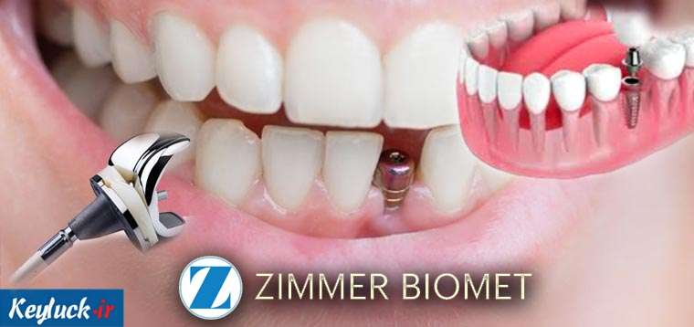 ایمپلنت آمریکایی زیمر + قیمت